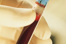 What Causes a High Level of Protein in the Blood?