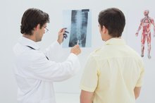 Glucosamine Chondroitin, MSM & Treatment of Degenerative Disc Disease