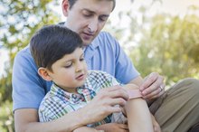 How to Avoid Scars From Brush Burns