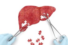 Metabolic Functions of the Liver