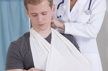 Physical Therapy for Coracoclavicular Ligament Injuries