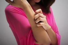 Why Do My Hands Itch at Night?