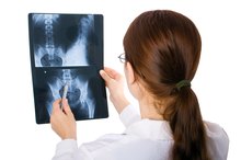 Kidney Stone Infection Symptoms
