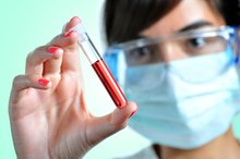 Dangers of Low Triglyceride Levels