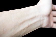 Iron Deficiency & Skin