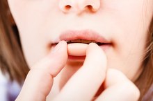 Marvelon in Treating Acne