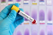 Normal Creatinine Levels in Urine