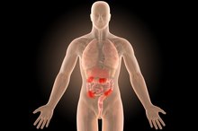 How to Eat With Diabetes and Crohn's Disease