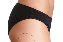 Side Effects of Laser Liposuction