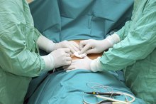 Signs and Symptoms of Leaking Breast Implants