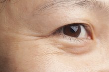 Bio Oil for Wrinkles