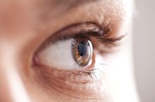 Keratoconus and Diet