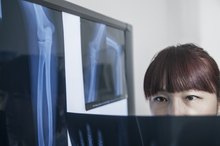 Bone Eating Diseases