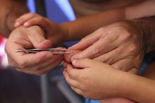 How to Remove Glass Splinters
