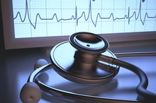 Premature Heartbeat & Exercise