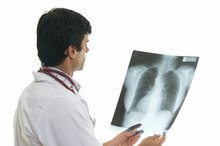 Rehab for a Broken Rib