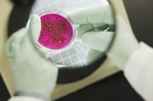 The Difference Between a Fungus & Bacteria