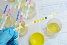 What Are the Causes of Kidney Scarring?