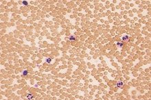 Foods That Increase White Blood Cells