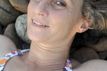 How to Treat Hyperpigmentation Spots on Arms & Legs