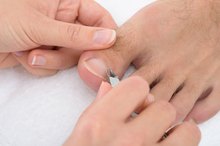 Home Remedies for Cutting Thick Toenails