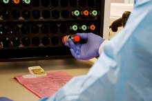 Blood Tests to Check Your Metabolism