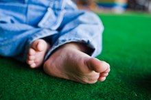 How to Correct Upward Toenails