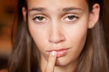 Over-the-Counter Treatments for Eczema Around the Lips