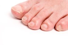 How to Trim a Toenail Correctly