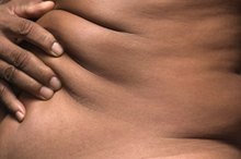 What Is the Best Thing for Firming Sagging Skin?