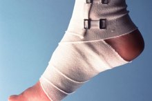 Why Does the Side of My Foot Hurt When Exercising?