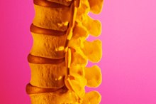 Exercise Therapy for Severe Degenerative Disc Disease L5-S1