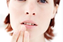 Can You Exercise With Herpes?