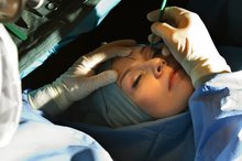 Disadvantages of Plastic Surgery