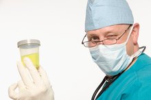 Should I Worry if My Urine Smells of the Food I Just Ate?