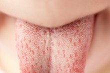 How to Get a Smooth Tongue