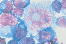 How to Calculate Absolute Granulocyte Count