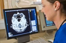 Dark Spots on the Brain