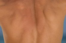 What Causes Men to Grow Back Hair?