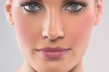 Skin Discoloration on the Forehead