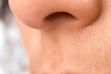 Causes of a Red Nose