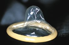 Causes of Whitish Yellowish Vaginal Discharge