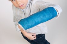 Difference Between Fiberglass & Plaster Cast