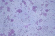 The Effects of Temperature on E. Coli