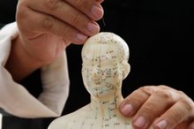 What Are the Acupuncture Points for Tennis Elbow?