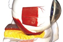 Exercise & Posterior Vitreous Detachment