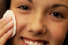 How to Treat a Facial Mosquito Bite