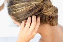 Listerine for Itchy Scalp