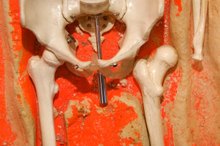 Exercises for Osteitis Pubis Rehabilitation