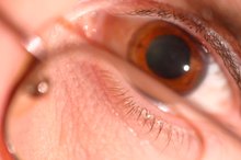 Side Effects of Dilating Eyes
